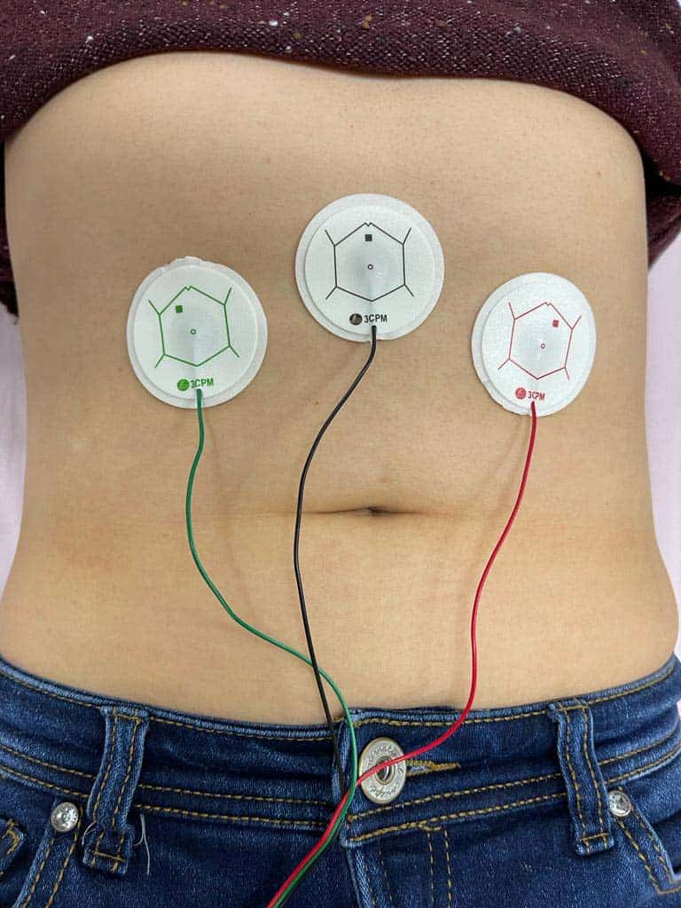 EndoSure-sensors
